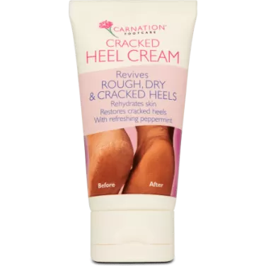 sarokbőr simító krém 50 g